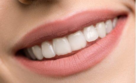 Izbeljivanje zuba: Osvježite svoj osmeh!